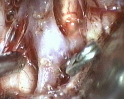 clip applicata