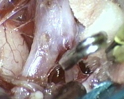 clip applicata