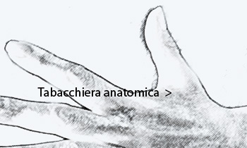 Tabacchiera anatomica (atrofia del primo inteosseo dorsale e delladduttore del pollice)
